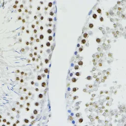 Anti-ZEB1 antibody used in IHC (Paraffin sections) (IHC-P). GTX33589