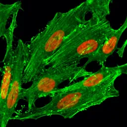 Anti-Histone H2A.Z (Acetyl Lys7) antibody [RM222] used in Immunocytochemistry/ Immunofluorescence (ICC/IF). GTX33592