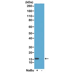 Anti-Histone H2A.Z (Acetyl Lys7) antibody [RM222] used in Western Blot (WB). GTX33592