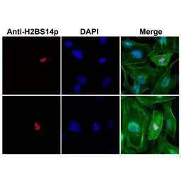 Anti-Histone H2B (phospho Ser14) antibody [RM238] used in Immunocytochemistry/ Immunofluorescence (ICC/IF). GTX33598