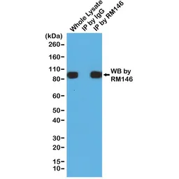 Anti-6X His tag antibody [RM146] used in Immunoprecipitation (IP). GTX33607