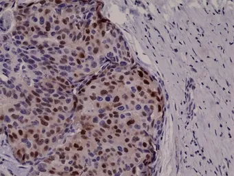 Anti-Cyclin D1 antibody [RM241] used in IHC (Paraffin sections) (IHC-P). GTX33611