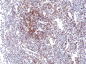 Anti-Cyclin D1 antibody [RM241] used in IHC (Paraffin sections) (IHC-P). GTX33611
