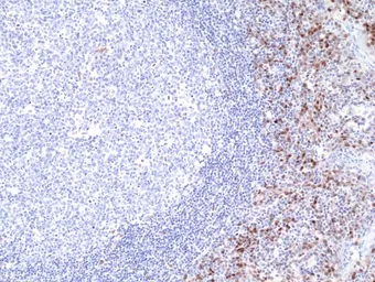Anti-Cyclin D1 antibody [RM241] used in IHC (Paraffin sections) (IHC-P). GTX33611