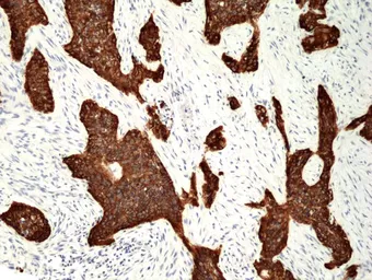 Anti-Cytokeratin 5 antibody [RM226] used in IHC (Paraffin sections) (IHC-P). GTX33612