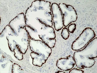 Anti-Cytokeratin 5 antibody [RM226] used in IHC (Paraffin sections) (IHC-P). GTX33612