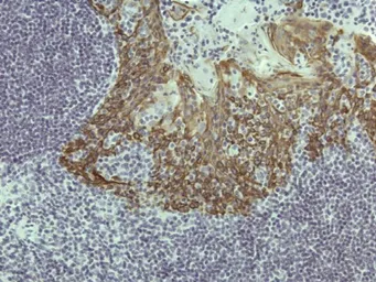 Anti-Cytokeratin 5 antibody [RM226] used in IHC (Paraffin sections) (IHC-P). GTX33612