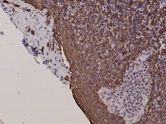 Anti-Cytokeratin 5 antibody [RM226] used in IHC (Paraffin sections) (IHC-P). GTX33612