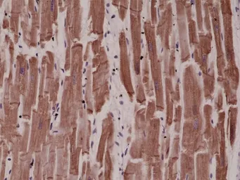 Anti-Desmin antibody [RM234] used in IHC (Paraffin sections) (IHC-P). GTX33613
