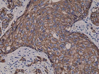 Anti-Her2 / ErbB2 antibody [RM228] used in IHC (Paraffin sections) (IHC-P). GTX33616