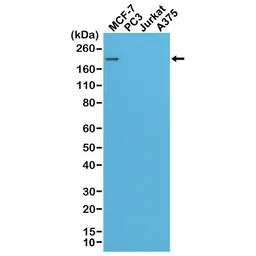 Anti-Her2 / ErbB2 antibody [RM228] used in Western Blot (WB). GTX33616