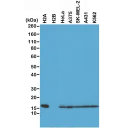 Anti-Histone H2A antibody [RM225] used in Western Blot (WB). GTX33618