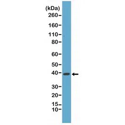 Anti-p38 MAPK antibody [RM245] used in Western Blot (WB). GTX33621