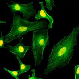 Anti-Macro H2A.1 antibody [RM248] used in Immunocytochemistry/ Immunofluorescence (ICC/IF). GTX33622