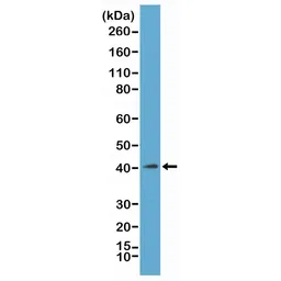 Anti-Macro H2A.1 antibody [RM248] used in Western Blot (WB). GTX33622