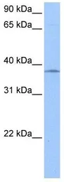 Anti-Sprouty 2 antibody used in Western Blot (WB). GTX33687