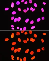 Anti-Histone H3R2me2 (Symmetric Di-methyl Arg2) antibody used in Immunocytochemistry/ Immunofluorescence (ICC/IF). GTX33905