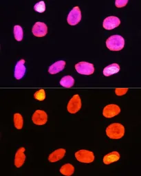 Anti-Histone H3R2me2 (Symmetric Di-methyl Arg2) antibody used in Immunocytochemistry/ Immunofluorescence (ICC/IF). GTX33905