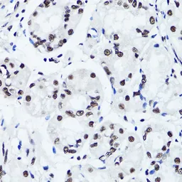 Anti-Histone H3R2me2 (Symmetric Di-methyl Arg2) antibody used in IHC (Paraffin sections) (IHC-P). GTX33905