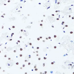 Anti-Histone H3R2me2 (Symmetric Di-methyl Arg2) antibody used in IHC (Paraffin sections) (IHC-P). GTX33905