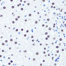 Anti-Histone H3R2me2 (Symmetric Di-methyl Arg2) antibody used in IHC (Paraffin sections) (IHC-P). GTX33905