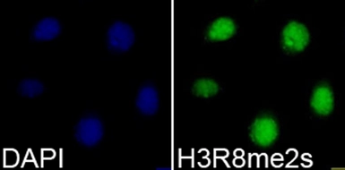 Anti-Histone H3R8me2 (Symmetric Di-methyl Arg8) antibody used in Immunocytochemistry/ Immunofluorescence (ICC/IF). GTX33906