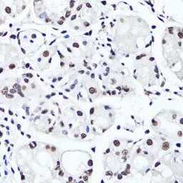 Anti-Histone H4R3me2 (Symmetric dimethyl Arg3) antibody used in IHC (Paraffin sections) (IHC-P). GTX33909