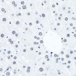 Anti-Histone H4R3me2 (Symmetric dimethyl Arg3) antibody used in IHC (Paraffin sections) (IHC-P). GTX33909