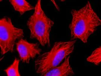 Anti-alpha Tubulin antibody [F2C] used in Immunocytochemistry/ Immunofluorescence (ICC/IF). GTX33912