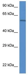 Anti-Plxdc2 antibody used in Western Blot (WB). GTX33946