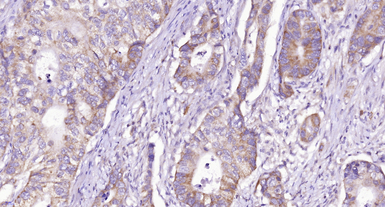 Anti-CD28 antibody used in IHC (Paraffin sections) (IHC-P). GTX33959