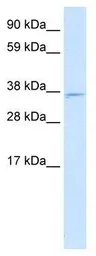Anti-Mxi1 antibody used in Western Blot (WB). GTX33961