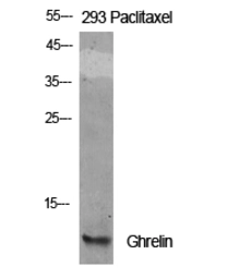 Anti-Ghrelin antibody used in Western Blot (WB). GTX33964