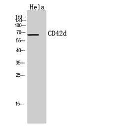 Anti-CD42d antibody used in Western Blot (WB). GTX33967
