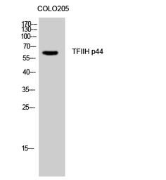 Anti-GTF2H2 antibody used in Western Blot (WB). GTX33983