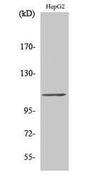 Anti-GTF3C2 antibody used in Western Blot (WB). GTX33984