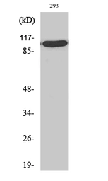 Anti-GTF3C3 antibody used in Western Blot (WB). GTX33985