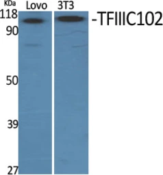 Anti-GTF3C3 antibody used in Western Blot (WB). GTX33985