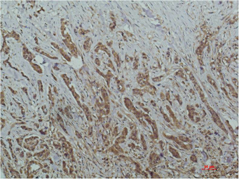 Anti-HDAC1 antibody [4E1] used in IHC (Paraffin sections) (IHC-P). GTX33988