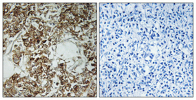 Anti-HLA-DOA antibody used in IHC (Paraffin sections) (IHC-P). GTX33991