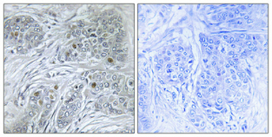 Anti-ID4 antibody used in IHC (Paraffin sections) (IHC-P). GTX34004