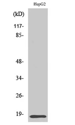 Anti-ID4 antibody used in Western Blot (WB). GTX34004
