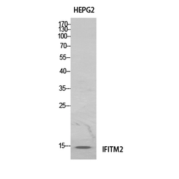 Anti-IFITM2 antibody used in Western Blot (WB). GTX34005