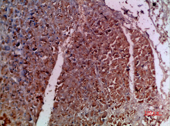 Anti-IL20 antibody used in IHC (Paraffin sections) (IHC-P). GTX34012