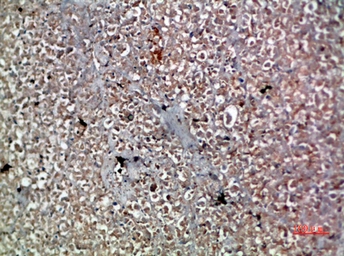 Anti-IL20 antibody used in IHC (Paraffin sections) (IHC-P). GTX34012