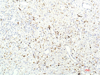 Anti-JAK1 antibody [7G6] used in IHC (Paraffin sections) (IHC-P). GTX34019