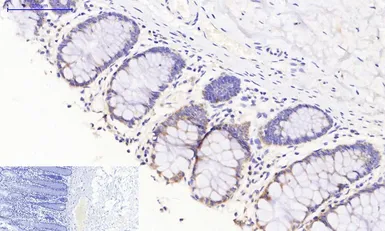 Anti-JAK3 antibody used in IHC (Paraffin sections) (IHC-P). GTX34020