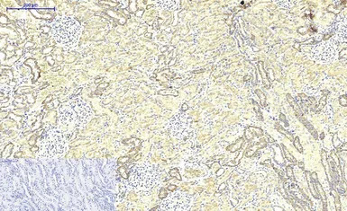 Anti-ABCB5 antibody [11A2] used in IHC (Paraffin sections) (IHC-P). GTX34025