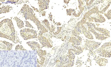 Anti-ABCB5 antibody [11A2] used in IHC (Paraffin sections) (IHC-P). GTX34025
