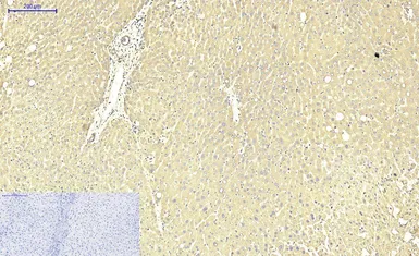 Anti-ABCB5 antibody [11A2] used in IHC (Paraffin sections) (IHC-P). GTX34025